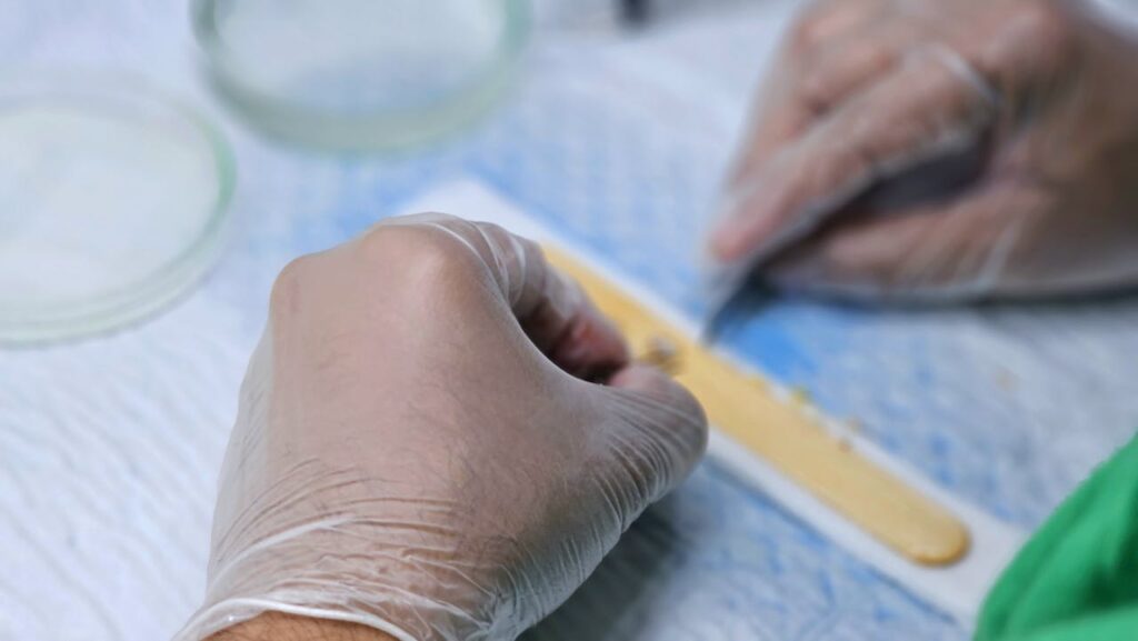 is hair transplant in turkey good?